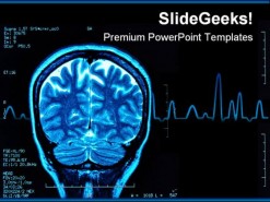 Brain Mri Medical PowerPoint Template 0610